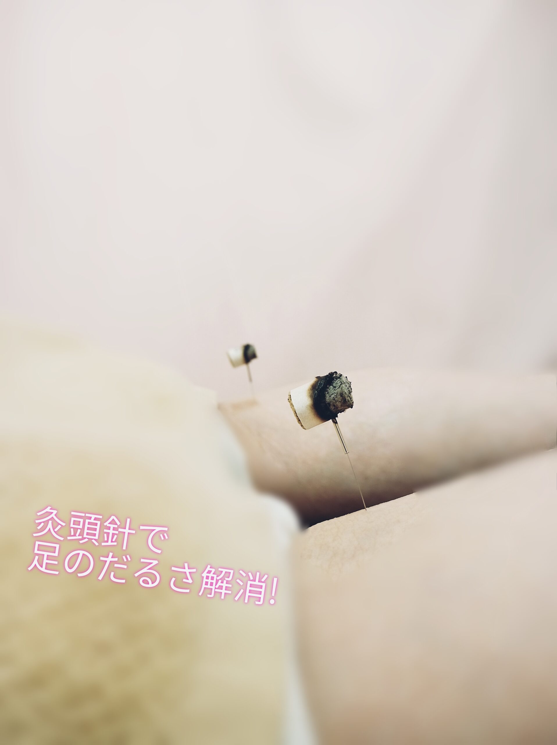 お灸熱い熱くない _ お灸いつやるといいか _ これを知れば怖くない！～お灸の熱さのお話～ – NXFJO